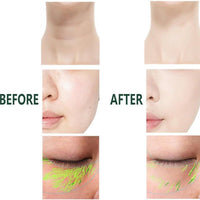 3-in-1 Anti-Wrinkle Facial Massager